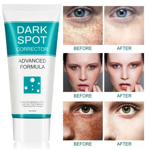 LD Pure Tone Dark Spot Serum