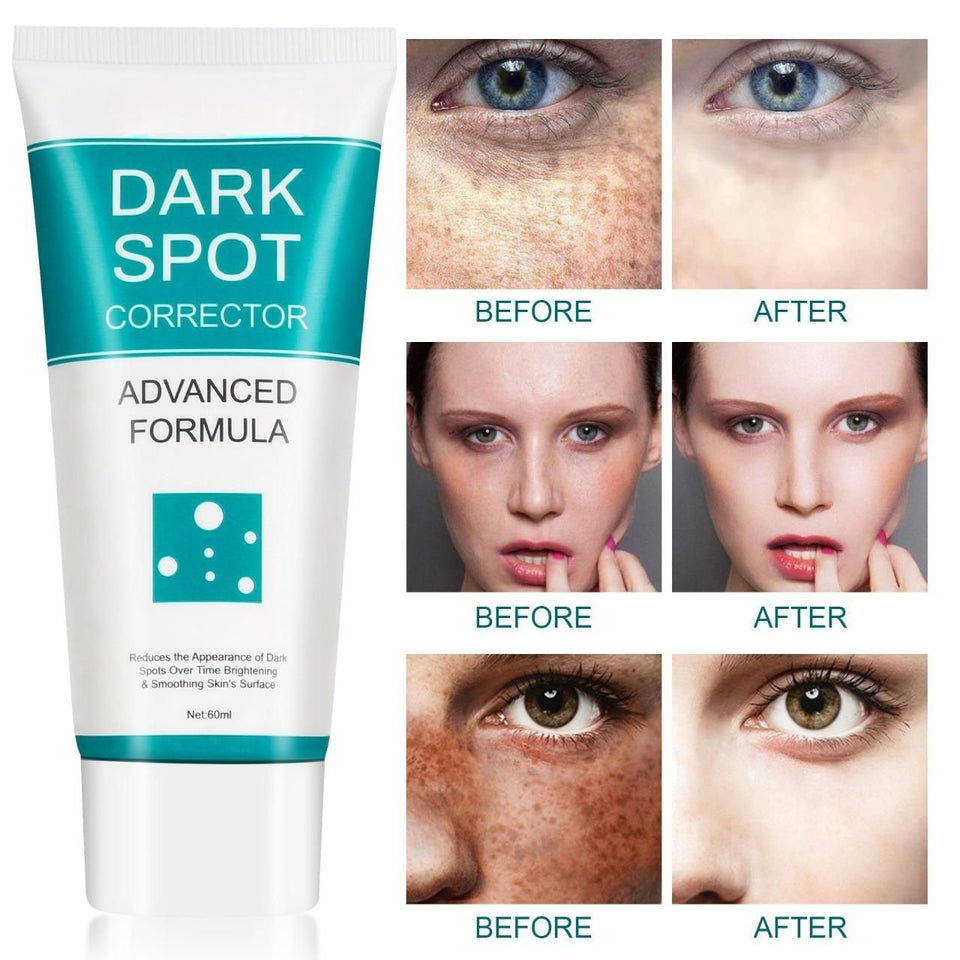 LD Pure Tone Dark Spot Serum